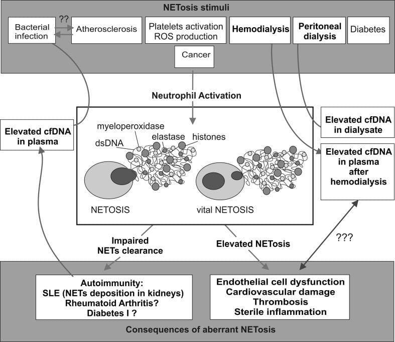 A pathophysiology diagram illustrating the pathways of NETosis activation, neutrophil response, and clinical consequences. The flowchart is organized into three horizontal sections. The top section, 'NETosis stimuli', lists triggers including bacterial infection, atherosclerosis, platelet activation with ROS production, hemodialysis, peritoneal dialysis, diabetes, and cancer. The middle section, 'Neutrophil Activation', depicts the biological process of suicidal NETosis and vital NETosis, illustrating the extracellular release of a meshwork composed of dsDNA, myeloperoxidase, elastase, and histones. Lateral boxes highlight clinical biomarkers such as elevated cell-free DNA (cfDNA) in plasma and dialysate. The bottom section, 'Consequences of aberrant NETosis', connects impaired NET clearance to autoimmune conditions like SLE and Rheumatoid Arthritis, as well as systemic complications including endothelial cell dysfunction, cardiovascular damage, thrombosis, and sterile inflammation. This educational graphic serves to demonstrate the link between innate immune dysregulation and chronic inflammatory diseases.