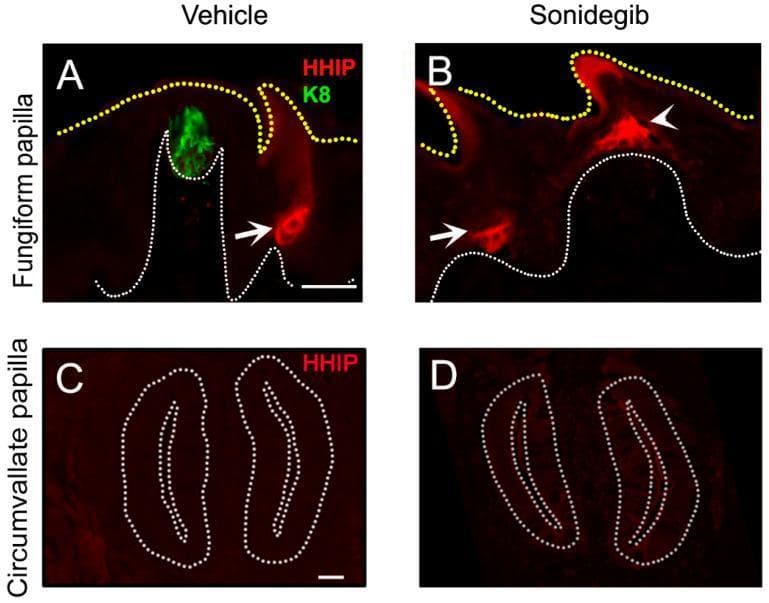 Fluorescence microscopy panels demonstrating Hedgehog (HH) antagonist HHIP expression (red) in lingual papillae under vehicle and Sonidegib (SMO inhibitor) treatment. Panels A and B focus on fungiform papillae (FGP). In the vehicle control (A), HHIP is localized to adjacent filiform papillae (arrow) but absent from the FGP and its K8-positive taste bud (green). After Sonidegib treatment (B), the FGP exhibits a conical morphological shift and ectopic HHIP expression at its apex (arrowhead), while filiform expression (arrow) persists. Panels C and D show circumvallate papillae (CVP). Unlike FGP, the CVP shows negligible HHIP expression in both vehicle (C) and Sonidegib (D) conditions, with no ectopic induction observed following HH pathway inhibition. White dotted lines demarcate the basal lamina/epithelial boundaries, and yellow dotted lines indicate the tongue surface. This comparison illustrates differential molecular and structural responses to HH pathway blockade between anterior (FGP) and posterior (CVP) taste organs, highlighting tissue-specific regulation of HH antagonism.
