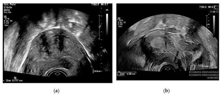 Hugging Face pmc clinical VQA raw
