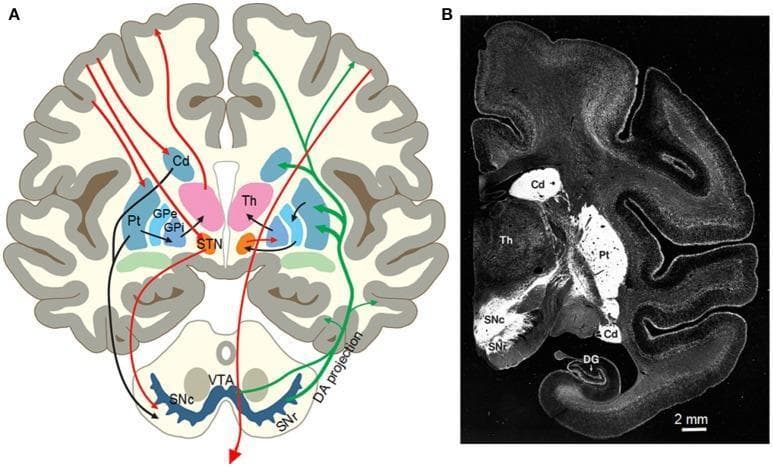 This dual-panel image provides an anatomical and histological overview of the basal ganglia and nigrostriatal systems. Panel A is a color-coded anatomical diagram of a coronal brain section illustrating basal ganglia circuitry. It depicts the direct pathway (red arrows), indirect pathway (black arrows), and dopaminergic (DA) projections (green arrows). Key labeled structures include the Caudate nucleus (Cd), Putamen (Pt), Thalamus (Th), Subthalamic Nucleus (STN), Globus Pallidus external (GPe) and internal (GPi) segments, Substantia Nigra pars compacta (SNc), Substantia Nigra reticulata (SNr), and Ventral Tegmental Area (VTA). Panel B is a coronal histological photograph of a monkey brain using Dopamine Transporter (DAT) immunostaining. The image shows intense white signal in the striatum (caudate and putamen) and the SNc, indicating high density of dopamine innervation compared to the darker surrounding cortical and thalamic tissue. This material is pedagogically significant for understanding Parkinson’s disease pathophysiology and the anatomical organization of motor control circuits.