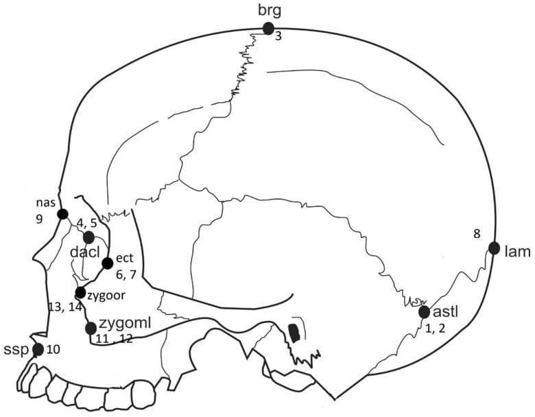 Anatomical diagram of a human skull in a lateral-oblique view, illustrating standard craniofacial landmarks used in forensic anthropology and morphometric analysis. The illustration highlights specific osteological points including: Bregma (brg) at the junction of the coronal and sagittal sutures; Lambda (lam) at the junction of the sagittal and lambdoid sutures; Asterion (astl) where the lambdoid, parietomastoid, and occipitomastoid sutures meet; Nasion (nas) at the intersection of the frontal and nasal bones; and Dacryon (dacl) within the medial orbital wall. Lower facial landmarks include the Ectoconchion (ect) on the lateral orbital margin, Zygoorbitale (zygoor), Zygomaxillare (zygoml) at the zygomatic-maxillary suture, and Subspinale (ssp) at the deepest point of the premaxillary curvature below the anterior nasal spine. Each point is numerically coded for reference to statistical data tables. This content is designed for educational use in anatomy, osteology, and forensic identification.