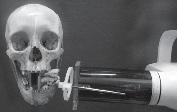 This clinical research photograph demonstrates a standardized dental radiography experimental setup using a human dry skull specimen. The image shows a frontal view of the skull with the mandible positioned to simulate a periapical or bitewing radiograph procedure. An intraoral dental film is fixed in a specialized film holder, which is attached to the posterior segment of the mandible. To replicate clinical conditions, a block of self-polymerizing acrylic resin is interposed on the buccal surface of the mandible to act as a soft tissue substitute. The x-ray machine's collimator (position-indicating device) is aligned perpendicular to the film, guided by a metal aiming rod and an external circular centering ring to maintain a fixed focus-film distance and geometric accuracy. This setup is characteristic of dental physics studies or quality assurance testing intended to evaluate the attenuation properties of different materials and their effect on radiographic image density and contrast in oral and maxillofacial radiology.