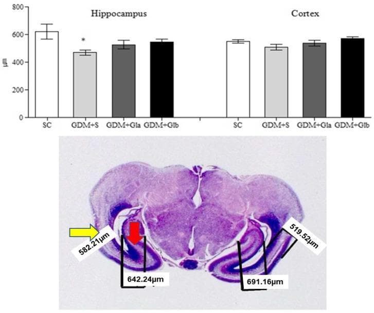 Educational composite image featuring a bar graph and a correlated histological section focused on fetal neuroanatomy and morphometric analysis in a Gestational Diabetes Mellitus (GDM) model. Top: A comparative bar graph displays tissue measurements in micrometers (µm) for two brain regions: the Hippocampus and the Cortex. Four experimental groups are compared: SC (Saline Control), GDM+S (Diabetic Saline), GDM+Gla, and GDM+Glb (Diabetic groups treated with Ganoderma lucidum). Data are shown as mean ± SD, with an asterisk highlighting a statistically significant decrease in hippocampal thickness in the GDM+S group compared to control. Bottom: A low-magnification (40X) photomicrograph of a fetal encephalon histological section stained with Hematoxylin and Eosin (H&E). The section shows the characteristic laminar organization of the developing brain. A yellow arrow identifies the cortex, while a red arrow points to the hippocampus. Superimposed linear measurement markers demonstrate how the morphometric data in the graph were obtained, with specific values indicated in micrometers. This material illustrates the impact of maternal diabetes on fetal brain development and the potential neuroprotective effects of Ganoderma lucidum.