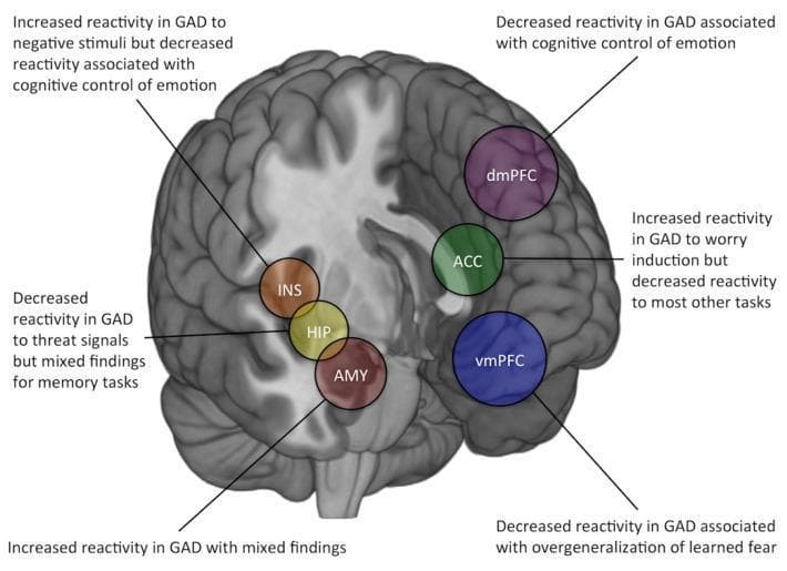 This medical illustration presents a medial sagittal view of the human brain, serving as an anatomical diagram of the corticolimbic circuit with functional annotations related to generalized anxiety disorder (GAD). Key regions are highlighted with color-coded circular overlays: the dorsomedial prefrontal cortex (dmPFC, purple), anterior cingulate cortex (ACC, green), ventromedial prefrontal cortex (vmPFC, blue), insula (INS, brown), hippocampus (HIP, yellow), and amygdala (AMY, red). The diagram summarizes findings from task-based fMRI studies, indicating how reactivity changes in these regions correlate with GAD symptoms. Specific annotations note increased amygdala (AMY) reactivity, decreased dmPFC and vmPFC reactivity associated with cognitive control of emotion and fear overgeneralization, and task-dependent reactivity patterns in the ACC, INS, and HIP. This educational resource is designed to illustrate the neurobiological mechanisms of anxiety disorders, highlighting the relationship between structural neuroanatomy and functional BOLD signal abnormalities in psychiatric pathophysiology.