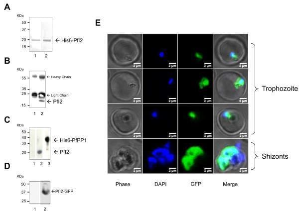 This composite image illustrates the molecular analysis and subcellular localization of the Plasmodium falciparum Inhibitor-2 (PfI2) protein. Panels A-D display western blots: (A) demonstrates purified His6-PfI2 at ~20 kDa; (B) shows immunoprecipitated native PfI2 with corresponding heavy and light chains; (C) reveals interaction between PfI2 and His6-PfPP1 (~40 kDa) via affinity purification; and (D) confirms the expression of a PfI2-GFP fusion protein at ~37 kDa. Panel E presents fluorescence microscopy of live transfectants across the erythrocytic cell cycle. It uses Phase contrast, DAPI (nuclear staining, blue), and GFP (PfI2-GFP, green) channels to visualize localization. In the trophozoite stage, PfI2-GFP exhibits a concentrated nucleo-cytoplasmic distribution near the nucleus. In the shizont stage, both DAPI and GFP signals become more diffuse and intense, occupying a larger volume of the parasite with significant overlap. The absence of GFP signal in the digestive vacuole is noted. This figure serves as a diagnostic and educational resource for understanding parasite protein expression and regulatory interactions in malaria research.