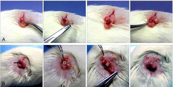 Clinical photograph series documenting a comparative surgical procedure in a rodent model, specifically used in oncological research for chemical induction of ovarian cancer. Row A illustrates the 'Sutures' (S) group: an exposed reddish-pink rat ovary is manipulated with surgical forceps and a needle driver to insert a 3-0 silk suture coated with 7,12-dimethylbenz(a)anthracene (DMBA). The process involves deep tissue penetration to deliver the carcinogen. Row B illustrates the 'Cloth Strip' (CS) group: a small square of DMBA-coated cloth (indicated by a white asterisk) is carefully packed onto the surface of the ovary after dissecting the membranous pouch. Key instruments shown include curved forceps, needle drivers, and sutures. The images demonstrate the variation in mechanical delivery methods—deep insertion via suture versus surface packing via cloth strip—designed to evaluate the developmental origins of ovarian epithelial adenocarcinomas versus other non-epithelial histological types.