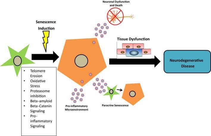 This pathophysiology diagram illustrates the process of 'astrosenescence' and its contribution to neurodegenerative disease within the central nervous system (CNS). The flowchart begins with a healthy, star-shaped astrocyte encountering 'Senescence Induction' triggers, including telomere erosion, oxidative stress, proteasome inhibition, beta-amyloid, and pro-inflammatory signaling. Post-induction, the astrocyte transforms into a larger, pentagonal senescent cell. This senescent astrocyte establishes a 'Pro-inflammatory Microenvironment' by secreting factors (depicted as purple hexagons) characteristic of a Senescence-Associated Secretory Phenotype (SASP). The diagram highlights three primary downstream effects: 1) 'Neuronal Dysfunction and Death,' represented by a neuron with a red strike-through; 2) 'Paracrine Senescence,' where secreted factors induce senescence in neighboring healthy astrocytes; and 3) general 'Tissue Dysfunction' involving altered cellular morphology. The terminal outcome of these integrated pathways is categorized as 'Neurodegenerative Disease.' This visual serves as an educational summary of how cellular aging in glia disrupts homeostasis and promotes chronic pathology in the brain.