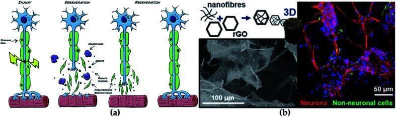 This composite educational graphic illustrates the pathophysiology of nerve injury and modern tissue engineering repair strategies. Panel (a) is a Pathophysiology Diagram showing a timeline of nerve regeneration: initial 'Injury' to an axon and its Schwann cell sheath; 'Degeneration' characterized by axonal breakdown, debris, and macrophage infiltration; and 'Regeneration' featuring proliferating Schwann cells and axonal regrowth toward the muscle target. Panel (b) focuses on Nanomaterial-based therapeutics, presenting a schematic of nanofibers combined with reduced graphene oxide (rGO) to create a 3D scaffold. This is supported by a scanning electron microscope (SEM) image showing the microscale architecture of the GO-based scaffold and a fluorescence microscopy image (50 μm scale) demonstrating cellular integration. In the fluorescence image, neurons are labeled in red as elongated fibers, while non-neuronal cells and nuclei are visible in green and blue. The visual highlights the intersection of neurology and regenerative medicine, specifically the use of conductive carbon-based nanomaterials to enhance neural progenitor cell viability and differentiation.