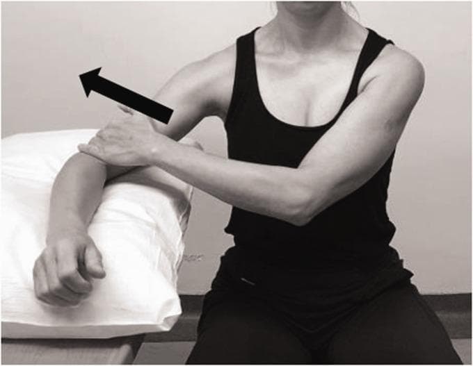 This clinical photograph demonstrates an isometric strengthening exercise for the middle deltoid, typically utilized in postoperative rehabilitation following Reverse Total Shoulder Arthroplasty (RTSA) or for patients with rotator cuff deficiency. The patient is shown in a seated position, wearing a sleeveless top to allow for visualization of shoulder mechanics. The target arm is positioned in approximately 30 to 45 degrees of abduction in the scapular plane, with the elbow resting on a supportive cushion. A black directional arrow indicates an upward force, representing isometric abduction where the patient resists gravity or provides self-resistance. This specific positioning is designed to optimize recruitment of the middle deltoid fibers while maintaining joint stability and minimizing stress on the acromion. The exercise is fundamental in physical therapy protocols aimed at improving deltoid activation and compensatory stabilization in the absence of a functional rotator cuff.