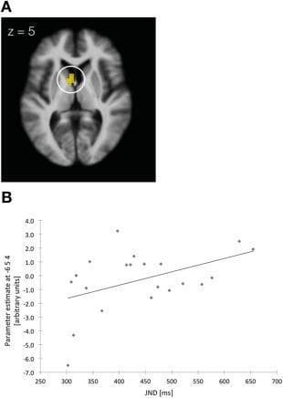 This composite educational figure illustrates the neuroanatomical correlates of action prediction sensitivity. Part A is a diagnostic fMRI image displaying an axial brain slice (z = 5) on a normalized T1-weighted template. A white circle highlights a region of interest (ROI) in the left head of the caudate nucleus, showing a significant positive correlation (p < 0.005, uncorrected) between neural activity and the observer's Just Noticeable Difference (JND). Part B is a corresponding scatter plot showing the relationship between behavioral and neural data. The x-axis represents the JND in milliseconds (ms), a measure of temporal sensitivity, while the y-axis represents the parameter estimate (in arbitrary units) extracted from the peak voxel in the caudate (coordinates -6 5 4). The plot features a positive regression line, demonstrating that lower sensitivity in action prediction (indicated by a higher JND) is associated with increased engagement or metabolic activity in the basal ganglia, specifically the caudate nucleus. This figure is used to teach concepts related to the neural substrates of temporal perception and prediction error in the human brain.