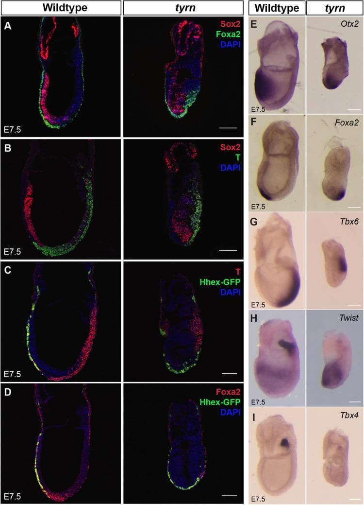 Educational developmental biology panel comparing wildtype and 'tyrn' (Pold1 hypomorph) mouse embryos at embryonic day E7.5. (A-D) Immunofluorescence (IF) images showing key gastrulation markers. Wildtype embryos display a well-extended primitive streak and organized anterior-posterior (A-P) axis, with Sox2 (red) marking the anterior neuroectoderm and Foxa2/T (Brachyury) labeling axial mesoderm and the primitive streak. In tyrn mutants, Sox2 is restricted to the distal tip, and T-staining reveals a significantly shortened primitive streak reaching only the posterior midpoint. (E-I) Whole-mount in situ hybridization (WISH) compares gene expression patterns. In mutants, Otx2 expression is shifted distally rather than anteriorly. Paraxial mesoderm marker Tbx6 is restricted to the posterior-proximal region in mutants, confirming defective primitive streak elongation. Twist and Tbx4 staining highlight a severe deficiency in extraembryonic mesoderm formation, particularly in the allantois, which is absent or drastically reduced in tyrn mutants. These visuals illustrate how impaired DNA synthesis due to Pold1 mutation disrupts cell proliferation, leading to failure in primitive streak extension and aberrant A-P axis orientation during mammalian gastrulation.