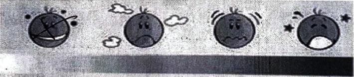 This visual aid is an adaptation of a Faces Pain Rating Scale used for clinical assessment of patient-reported discomfort, often categorized under the Visual Analogue Scale (VAS) methodology. The infographic consists of four progressive facial icons and a corresponding intensity gradient bar below. 1) The first icon features a smiling mouth and 'crossed' eyes, representing no pain or 'very bearable' sensation. 2) The second icon shows a frowning mouth and cloud symbols, indicating mild discomfort or emerging distress. 3) The third icon displays a wavy, distressed mouth and motion lines around the head, signifying moderate to high pain levels. 4) The final icon depicts a wide-open mouth, closed eyes, and star symbols, representing severe or maximum pain. This tool is utilized in clinical settings, such as post-procedural hysteroscopy evaluations, to help patients quantify subjective pain levels when verbal communication may be limited or to supplement numerical ratings.