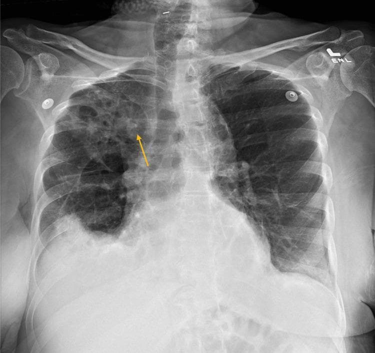 Hugging Face pmc clinical VQA raw