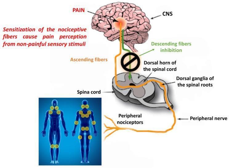 A medical illustration depicting the pathophysiology of central sensitization and pain processing pathways, specifically in the context of fibromyalgia. The graphic features a neuroanatomical diagram of the ascending and descending pain pathways alongside human figures marking tender point locations. The ascending pathway (orange line) begins at peripheral nociceptors, travels through the peripheral nerve to the dorsal ganglia of the spinal roots, enters the dorsal horn of the spinal cord, and terminates in the brain (CNS), where 'PAIN' perception occurs. A descending inhibitory pathway (green line) is shown originating in the brain but is intersected by a black prohibition symbol, indicating 'Descending fibers inhibition' failure or dysfunction. An inset image displays anterior and posterior human silhouettes with yellow circles marking 18 classic fibromyalgia tender points, including the neck, chest, elbows, hips, and knees. Text annotations explain that sensitization of nociceptive fibers causes pain perception from non-painful sensory stimuli, illustrating the concepts of hyperalgesia and allodynia.