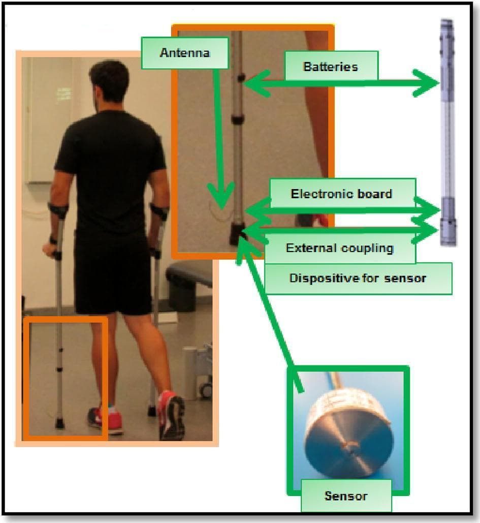 This composite educational illustration demonstrates the GCH 2.0 load measurement system integrated into a standard forearm crutch for gait analysis. The image consists of a clinical photograph showing a male subject using bilateral forearm crutches in a laboratory setting, a schematic of the internal hardware, and detailed callouts of the electronic components. The distal part of the crutch contains a miniaturized force sensor positioned at the base to measure ground reaction forces. Moving superiorly along the crutch shaft, the assembly includes an external coupling, an electronic board for signal processing, power batteries, and an antenna for wireless data transmission to a receiver. This system is designed for rehabilitation and orthopedic research to monitor load-bearing compliance during unilateral assisted gait (UAG). Educational focuses include biomechanics, physical therapy monitoring, and the use of assistive technology to evaluate weight-bearing percentages (e.g., 25% or 50% of body weight) during recovery from lower limb injury or surgery.