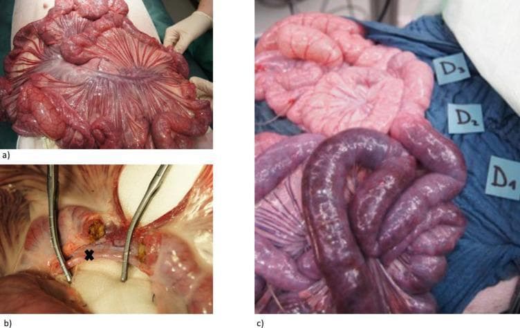 This set of clinical photographs depicts a porcine model of acute mesenteric ischemia used for surgical research. Panel A illustrates the initial surgical exposure (midline laparotomy) of the small intestine and the complex vascular anatomy of the meso-ileum. Panel B provides a close-up of the surgical dissection, showing a branch of the superior mesenteric artery (SMA) marked with an 'X' and stabilized by surgical forceps, demonstrating the technique for selective arterial occlusion. Panel C displays the macro-anatomical consequences of ischemia across three distinct zones labeled D1, D2, and D3. Zone D1 (ischemic) shows profound cyanosis with dark purple to black bowel loops, indicating severe congestion and lack of arterial perfusion. Zone D2 (transitional) shows intermediate pallor and mild dusky discoloration. Zone D3 (control) maintains a healthy, vibrant pink appearance, indicating normal perfusion. These images serve to illustrate the visual progression of bowel wall changes, from healthy tissue to irreversible ischemic injury, relevant for understanding vascular emergencies and surgical decision-making.