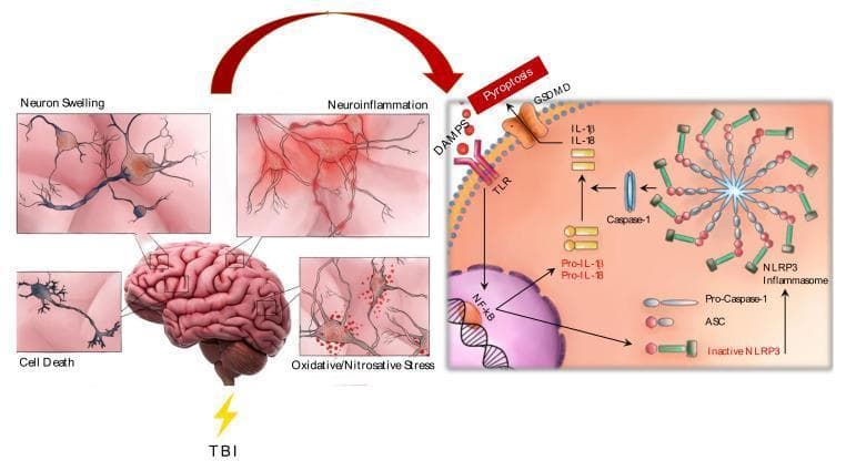 This pathophysiology diagram illustrates the cellular and molecular mechanisms of secondary injury following Traumatic Brain Injury (TBI). The left side features a brain illustration with four inset panels showing pathological processes: neuron swelling (cytotoxic edema), neuroinflammation (characterized by reactive gliosis and microglial activation), cell death (apoptosis/necrosis), and oxidative/nitrosative stress (indicated by mitochondrial dysfunction and ROS accumulation). The right side provides a detailed molecular schema of the NLRP3 inflammasome activation pathway. Damage-Associated Molecular Patterns (DAMPs) are shown interacting with Toll-Like Receptors (TLR), leading to NF-κB nuclear translocation and the synthesis of pro-IL-1β and pro-IL-18. The assembly of the NLRP3 inflammasome from inactive NLRP3, ASC, and pro-caspase-1 is depicted as a circular oligomeric complex. Active caspase-1 then cleaves the pro-cytokines into their mature forms (IL-1β, IL-18) and facilitates gasdermin D (GSDMD) mediated pyroptosis. This diagram summarizes the link between acute mechanical trauma and the chronic inflammatory cascade in neurotrauma.