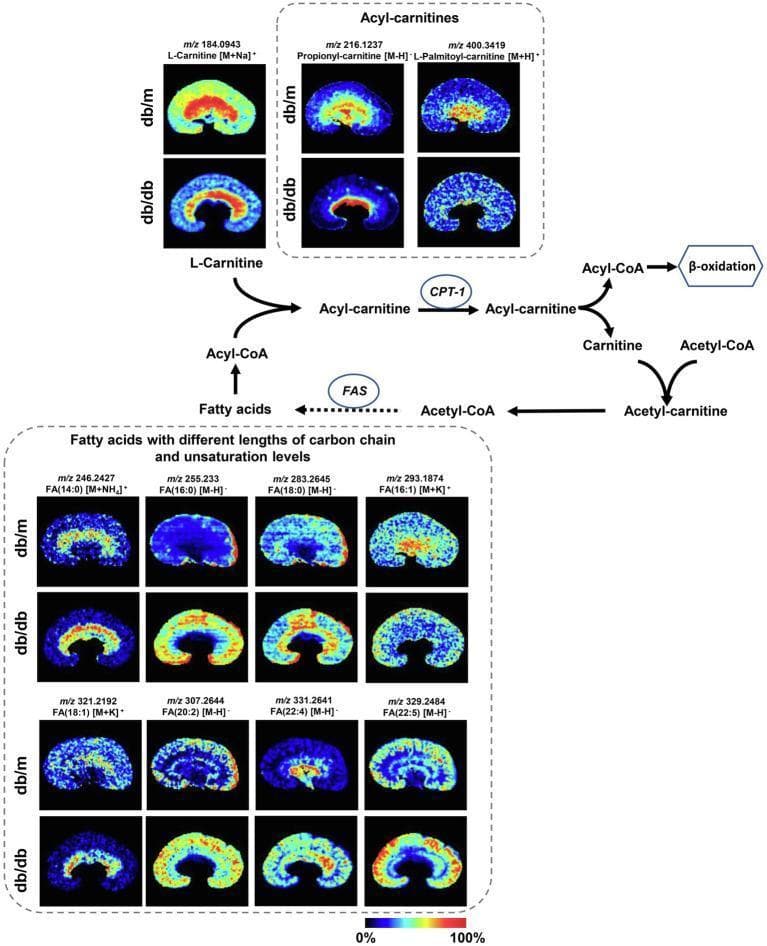This composite educational image features high-resolution Mass Spectrometry Imaging (MSI) paired with a pathophysiology flow diagram illustrating metabolic reprogramming in Diabetic Kidney Disease (DKD). The visual comparison highlights molecular distribution differences between control (db/m) and diabetic (db/db) mouse kidney models. The top panels display heat maps of L-carnitine and acyl-carnitines (propionyl-carnitine and L-palmitoyl-carnitine), showing a significant signal reduction in diabetic kidneys, particularly in the cortex and medulla. The bottom section presents MSI for various fatty acids with varying chain lengths and unsaturation levels. It demonstrates an accumulation of saturated long-chain fatty acids (FA 14:0, 16:0, 18:0) and polyunsaturated fatty acids (FA 20:2, 22:4, 22:5) in the db/db group, indicated by higher intensity (red/yellow) compared to db/m. Interspersed biochemical flowcharts show the roles of rate-limiting enzymes, specifically CPT-1 (carnitine O-palmitoyl-transferase 1) in fatty acid degradation and FAS (fatty acid synthase) in biosynthesis. This content is designed for advanced medical education in nephrology and metabolic biochemistry to visualize histology-specific metabolic dysfunction.