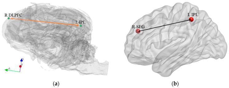 Anatomical comparison of functional connectivity within the fronto-parietal network (FPN) in the canine and human brain. (a) A 3D wireframe reconstruction of a dog brain illustrating the connectivity between the Right Dorsolateral Prefrontal Cortex (R DLPFC) and the Left Inferior Parietal Region (L IPL), indicated by an orange arrow. (b) A 3D cortical rendering of a human brain showing homologous connectivity between the Right Superior Frontal Region (R SFG) and the Left Inferior Parietal Region (L IPL), indicated by a black line. These visualizations highlight the evolutionary preservation of the FPN, a critical system involved in cognitive control, attention, and memory retrieval. The diagram serves to demonstrate how specific functional connections in these regions correlate with behavioral performance and neuroplasticity during training. Labels use standard neuroanatomical nomenclature, and R/L indicate right and left hemispheres respectively.