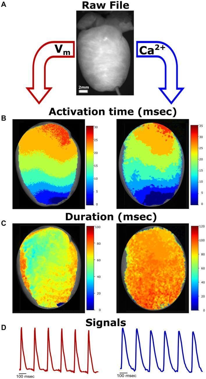This composite educational graphic illustrates the workflow for cardiac optical mapping, specifically focusing on the simultaneous analysis of transmembrane voltage (Vm) and intracellular calcium (Ca2+) in a mammalian heart model. Panel A shows the raw grayscale image of a Langendorff-perfused heart. Panel B presents activation time maps in milliseconds (msec) for both Vm and Ca2+. These pseudocolor maps demonstrate the propagation of electrical and calcium signals from the apex (blue, indicating earlier activation) toward the base (red, indicating later activation), reflecting the coordinated cardiac conduction sequence. Panel C displays duration maps for the action potential and calcium transients. The Vm duration map (left) utilizes a scale up to 100 msec, while the Ca2+ duration map (right) extends to 120 msec, highlighting the characteristically longer duration of calcium transients. Panel D provides representative temporal signal traces, showing the morphology of repetitive action potentials and calcium transients. This figure serves as a diagnostic tool for evaluating excitation-contraction coupling and regional heterogeneity in cardiac electrophysiology.