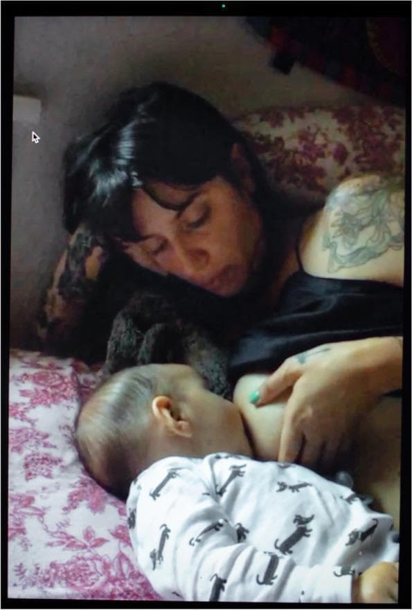 This clinical photograph captures a successful breastfeeding interaction between a mother and her infant, illustrating healthy lactation and latch. The mother is positioned in a side-lying or reclined posture on a bed with floral linens, supporting the infant's nursing at the left breast. The infant is oriented horizontally, showing a deep latch with the mouth wide open over the nipple and areola, and chin against the breast—key indicators of effective milk transfer. The mother appears calm, with fair skin, dark hair, and visible tattoos on her shoulder and forearm. The infant is wearing a patterned white long-sleeved sleeper. The image serves as a visual reference for postpartum maternal-infant bonding and physiological lactation. Historically, this photograph represents the restoration of breastfeeding following a resolved clinical complication, such as mastitis or a breast abscess, emphasizing the importance of lactation support and the physical resilience of the mammary system during the postpartum period.
