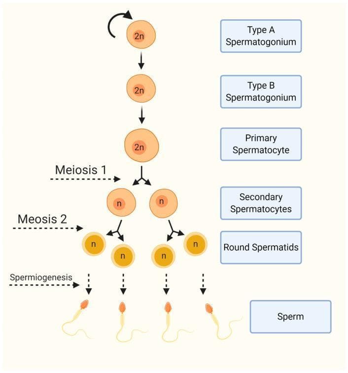 An educational pathophysiology diagram illustrating the stages of human spermatogenesis and the progression of germ cell differentiation. The flowchart follows a vertical linear-to-branched structure. The process begins with diploid (2n) germ cells: Type A Spermatogonium, which shows a self-renewal loop, followed by Type B Spermatogonium and Primary Spermatocyte. The diagram then depicts Meiosis I, transitioning from one primary spermatocyte to two haploid (n) Secondary Spermatocytes. Meiosis II follows, leading to the formation of four haploid (n) Round Spermatids. The final stage, labeled Spermiogenesis, demonstrates the morphological transformation from round cells into mature Sperm (spermatozoa), characterized by the development of a distinct head and flagellum. The diagram emphasizes key cellular events, including chromosomal reduction from diploid to haploid states and the structural evolution of the male gamete, making it a central resource for understanding male reproductive biology and gametogenesis.