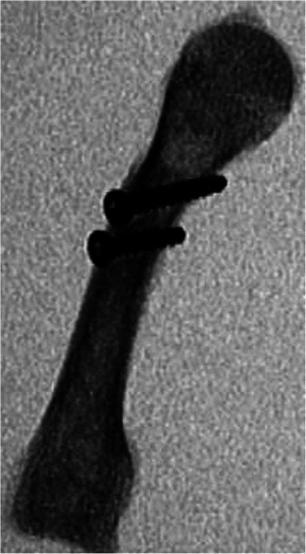 This lateral fluoroscopic image displays a long bone, specifically a metacarpal, featuring an oblique osteotomy (surgical fracture) in the mid-diaphysis. The bone is oriented obliquely with its proximal head at the upper right and the distal base at the lower left. The surgical fixation consists of two radiopaque metallic lag screws. These screws are placed in parallel and are oriented perpendicular to the oblique osteotomy line to provide interfragmentary compression. The screw heads are visible at the near cortex, and the threaded shafts extend across the radiolucent fracture line into the far cortex. This image serves as a teaching tool for orthopedic surgery, demonstrating standard internal fixation techniques for long bone shaft fractures using lag screw constructs. The key anatomical regions visible include the epiphysis, metaphysis, and diaphysis of the metacarpal.
