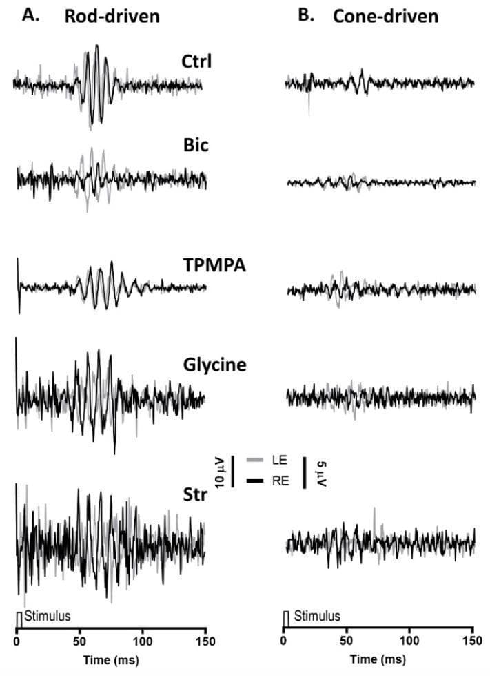 This diagnostic comparison chart displays representative electroretinogram (ERG) recordings of oscillatory potentials (OPs) under two physiological conditions: (A) Rod-driven OPs under dark adaptation (scotopic) and (B) Cone-driven OPs under light adaptation (photopic). The figure illustrates the effects of different pharmacological agents injected into the right eye (RE, black trace) compared to a control phosphate-buffered saline injection in the left eye (LE, grey trace). Conditions include Control (Ctrl), Bicuculline (GABAA antagonist), TPMPA (GABAC antagonist), Glycine, and Strychnine (glycine antagonist). In the rod-driven series (A), control traces show high-amplitude, regular rhythmic oscillations. Bicuculline reduces amplitude while preserving periodicity, TPMPA shows negligible effect, and both Glycine and Strychnine significantly disrupt the regularity and amplitude of the waveform. The cone-driven series (B) demonstrates much lower baseline amplitude and less distinct oscillatory components, with pharmacological intervention resulting in waveforms that are nearly indistinguishable from noise. Scales indicate 10 µV for rod-driven and 5 µV for cone-driven traces over a 150 ms time course. This visualization demonstrates the role of inhibitory neurotransmitters in the genesis of retinal oscillatory potentials.