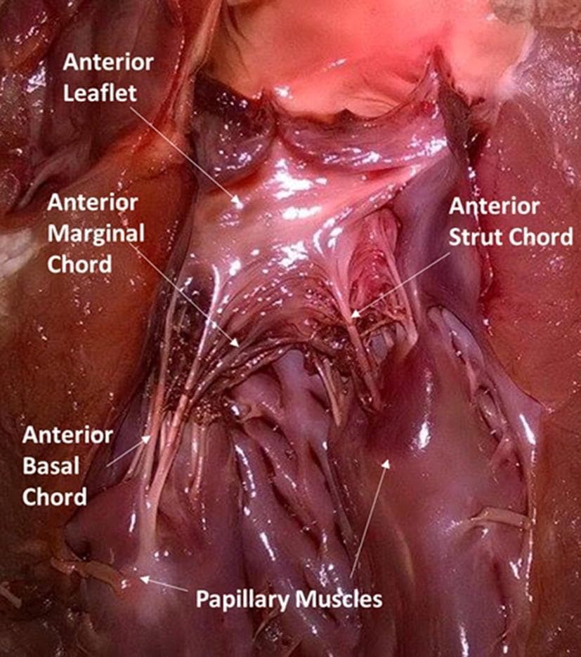 This clinical photograph of a porcine cardiac specimen (used as a model for human anatomy) illustrates the structural components of the mitral valve apparatus. The image highlights the anterior mitral valve leaflet and its associated chordae tendineae and papillary muscles. Key anatomical structures are labeled: the anterior leaflet appears as a translucent, pinkish-white fibrous sheet; the robust, reddish-purple papillary muscles serve as the inferior anchoring point. The description identifies three specific types of chordae tendineae based on their insertion points: the anterior marginal chord (attaching to the leaflet edge), the anterior basal chord (attaching to the leaflet base), and the anterior strut chord (thicker support structures attaching to the leaflet body). This specimen demonstrates the complex spatial relationship between the ventricular wall and the valvular leaflets, essential for understanding cardiac mechanics, valvular competence, and surgical repair techniques in cardiology and cardiothoracic surgery.