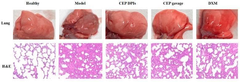 A composite medical comparison image demonstrating lung pathology across five experimental conditions: Healthy, Model (Acute Lung Injury), CEP DPIs, CEP gavage, and DXM (Dexamethasone). The top row contains macroscopic clinical photographs of whole lung tissue. The 'Healthy' lung is light pink and smooth, while the 'Model' lung shows significant dark red discoloration, bruising, and edema. Treatment groups (CEP and DXM) show macroscopic recovery towards a normal pink appearance. The bottom row presents corresponding histopathological sections stained with hematoxylin and eosin (H&E) at 100x magnification. The 'Healthy' section reveals clear, thin-walled alveolar sacs. In contrast, the 'Model' section shows severe alveolar architectural destruction, marked thickening of alveolar septa, and dense inflammatory cell infiltration. The treatment groups, particularly the Cepharanthine dry powder inhaler (CEP DPIs) and DXM, demonstrate significant histological attenuation of injury, characterized by reduced septal thickening and decreased leucocyte infiltration, illustrating the anti-inflammatory efficacy of these interventions in a model of chemical-induced lung injury.