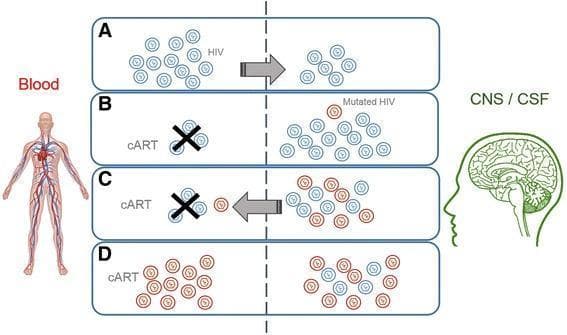 This pathophysiology diagram illustrates the development of HIV drug resistance using the central nervous system (CNS) as a sanctuary reservoir. The diagram is divided into four chronological stages (A-D) across two compartments: Blood and CNS/CSF. Stage A shows the initial phase where blue (wild-type) HIV virions replicate in the blood and cross the blood-brain barrier. Stage B depicts the initiation of combination antiretroviral therapy (cART), indicated by a crossed-out virion in the blood, while the virus continues to replicate in the CNS due to poor drug penetration, leading to a red 'mutated HIV' variant. Stage C shows the mutated virus re-entering the bloodstream despite continued cART. Stage D illustrates treatment failure, where drug-resistant mutant virions (red) dominate both compartments, replicating efficiently despite therapy. The diagram emphasizes viral compartmentalization and the role of the CNS in maintaining proviral load, which contributes to neurologic abnormalities in HIV-infected patients.