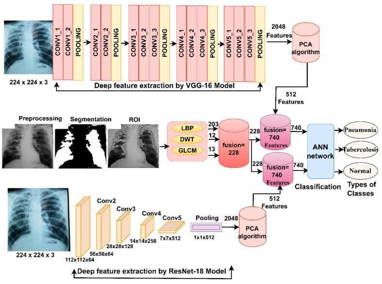 A technical flowchart illustrating a deep learning framework for the automated diagnosis and differential classification of pneumonia, tuberculosis, and normal chest X-rays. The architecture follows a multi-pathway feature extraction approach. Initially, chest X-ray images undergo preprocessing, lung field segmentation, and Region of Interest (ROI) extraction. Hand-crafted features are then extracted using Local Binary Pattern (LBP), Discrete Wavelet Transform (DWT), and Gray-Level Co-occurrence Matrix (GLCM), totaling 228 features. Concurrently, two deep learning pathways extract high-dimensional features (2048 each) via VGG-16 and ResNet-18 architectures. These are reduced to 512 features each using Principal Component Analysis (PCA). The reduced deep features are fused with the 228 hand-crafted features, creating combined feature vectors of 740. These integrated features are fed into an Artificial Neural Network (ANN) classifier to produce the final clinical classification. This methodology highlights the integration of traditional radiomics with modern computer vision for improved diagnostic accuracy in thoracic pathology.
