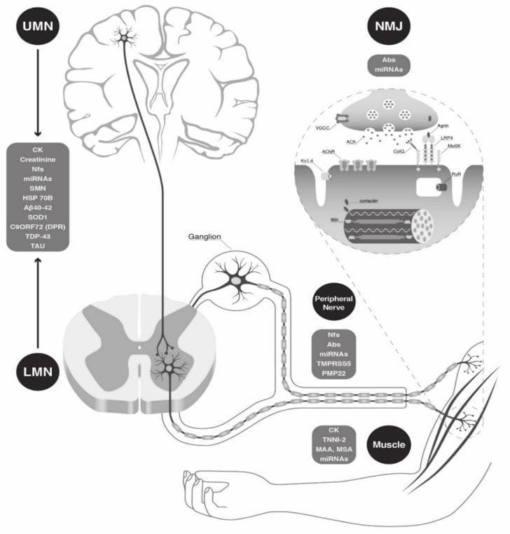 This medical illustration is a pathophysiology diagram detailing the anatomical components of the human neuromuscular unit and their associated circulating biomarkers. The schematic follows a top-down approach: 1) Upper Motor Neuron (UMN), shown within a coronal section of the brain with listed biomarkers including CK, Nfs, miRNAs, and neurodegenerative markers like TDP-43 and A̠40-42. 2) Lower Motor Neuron (LMN), depicted within a cross-section of the spinal cord, showing axons exiting via a ganglion into the peripheral nerve (associated with PMP22 and TMPRSS5). 3) Neuromuscular Junction (NMJ), magnified to show synaptic vesicles, ACh receptors, and muscle endplates with related antibodies (Abs) and miRNAs. 4) Skeletal Muscle, illustrated at the periphery with biomarkers such as CK, TNNI-2, and myositis-specific antibodies (MSA). The diagram serves as an educational tool for neurology and neuromuscular diseases, highlighting the potential for diagnostic and prognostic monitoring across the motor pathway from the central nervous system to the peripheral effector organ.