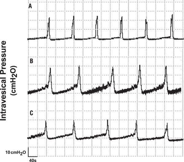 Cystometric recordings (cystometrogram) illustrating bladder pressure dynamics in an animal model of bladder autotransplantation. The image features three distinct waveforms labeled A, B, and C, plotted against intravesical pressure in cmH2O (y-axis) and time (x-axis), with a 40-second time scale and a 10 cmH2O pressure reference. Trace A represents the control state, showing rhythmic, high-amplitude, and narrow-duration micturition peaks with a stable baseline. Trace B shows physiological changes post-transplant with intermediate micturition intervals and irregular baseline activity. Trace C demonstrates the lowest maximal pressure amplitude, increased micturition duration (widened peaks), and gradual pressure rises during the filling phase, reflecting altered neobladder compliance or contractility. These tracings are used to evaluate urological functional outcomes such as maximal pressure amplitude, micturition interval, and duration in reconstructive surgery research.