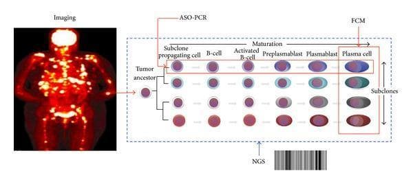 This composite educational graphic illustrates the complexity of Minimal Residual Disease (MRD) assessment in Multiple Myeloma (MM). The left panel features a full-body PET-CT maximum intensity projection (MIP) showing multifocal, hypermetabolic skeletal and extramedullary lesions (patchy involvement), emphasizing the utility of imaging for detecting non-uniform disease distribution. The right panel displays a pathophysiology diagram of clonal and cellular heterogeneity. It depicts a 'Tumor Ancestor' cell diverging into four distinct subclones. Each subclone undergoes a horizontal maturation process: subclone propagating cell, B-cell, activated B-cell, preplasmablast, plasmablast, and mature plasma cell. The diagram overlays three diagnostic detection windows: flow cytometry (FCM), which specifically targets the mature plasma cell stage; ASO-PCR, which captures the entire clonal lineage from progenitor to mature cell; and Next-Generation Sequencing (NGS), represented by a barcode, which covers the global tumor population. The figure highlights how cellular maturation and genetic subclonal variation impact the sensitivity and reach of different MRD monitoring techniques.