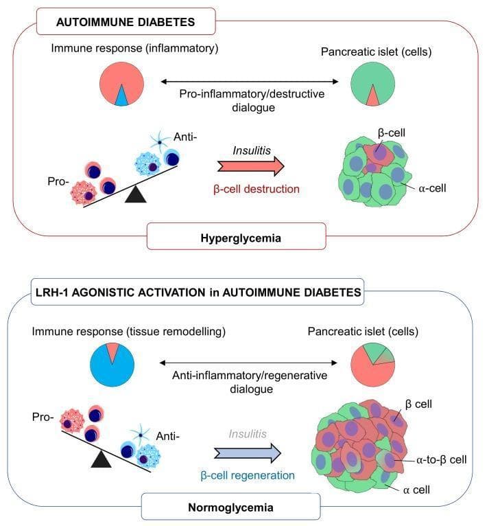 This pathophysiology diagram compares the disease state of autoimmune diabetes against the therapeutic intervention of LRH-1 agonistic activation. The top panel depicts autoimmune diabetes characterized by a pro-inflammatory immune response (red-dominant pie chart) interacting via a destructive dialogue with pancreatic islets. This results in a shift toward pro-inflammatory factors on a cellular balance scale, leading to insulitis, severe beta-cell destruction, reduced beta-cell mass, and clinical hyperglycemia. The bottom panel illustrates the effects of LRH-1 agonistic activation, which promotes tissue remodeling and an anti-inflammatory/regenerative immune response (blue-dominant pie chart). This intervention shifts the cellular balance toward anti-inflammatory factors, mitigating insulitis and stimulating beta-cell regeneration, specifically via alpha-to-beta cell transdifferentiation. The resulting pancreatic islet shows restored beta-cell mass, leading to a state of normoglycemia. Key educational concepts include the modulation of immune-islet crosstalk and the potential for regenerative medicine in type 1 diabetes mellitus through nuclear receptor signaling.