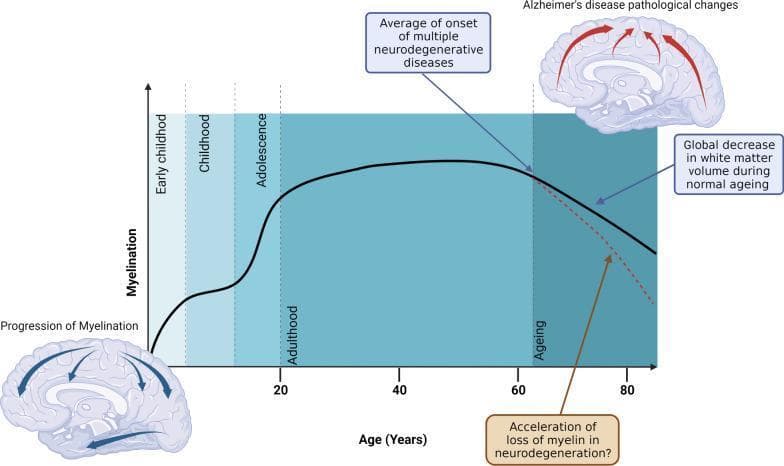 This medical schematic illustrates the longitudinal lifecycle of brain myelination across the human lifespan. The primary element is a line graph plotting myelination levels against age in years. The trajectory shows a rapid increase during early childhood, childhood, and adolescence, plateauing in adulthood and peaking around age 40-50. This is followed by a steady decline in the 'ageing' phase, labeled as a 'global decrease in white matter volume during normal ageing' (solid black line). A diverging dashed red line indicates a more rapid, 'accelerated loss of myelin in neurodegeneration' occurring after age 60. Annotations identify the 'average age of onset of multiple neurodegenerative diseases' coinciding with the start of the physiological decline. Accompanying sagittal brain illustrations visualize the 'progression of myelination' in early life with centrifugal blue arrows and 'Alzheimer’s disease pathological changes' in late life with red arrows indicating cortical destruction. This diagram serves as an educational tool for understanding white matter dynamics in neurology and geriatrics.