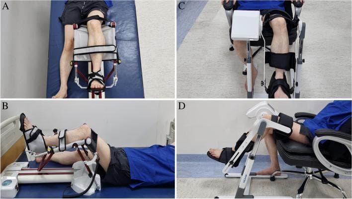 This composite clinical photograph illustrates two different Continuous Passive Motion (CPM) machine configurations used for postoperative knee rehabilitation, specifically following Total Knee Arthroplasty (TKA). Panels A and B demonstrate a conventional CPM setup (RCF1121®) where the patient is in a supine position on a hospital bed. The device frame rests horizontally, with the limb secured via adjustable straps at the thigh, mid-calf, and foot cradle to guide flexion and extension. Panels C and D show a newer CPM model (Resilion K20P®) designed for a seated position in a chair. This vertical-oriented mechanism features a distinct leg brace and foot plate system, supporting the limb while the patient remains upright. Both systems utilize padded stabilizers and mechanical hinges to automate range of motion (ROM) exercises. These images highlight the ergonomic differences between traditional supine therapy and modern seated rehabilitation protocols in orthopedic physical therapy.