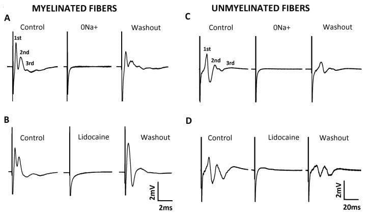 This physiological diagram illustrates extracellular recordings of compound action potentials (CAPs) from myelinated and unmyelinated nerve fibers, categorized into four panels (A-D). Panels A and B display CAP traces for myelinated fibers, characterized by high conduction velocities (scale bar: 2 ms). Panels C and D show unmyelinated fibers with slower conduction (scale bar: 20 ms). In the 'Control' conditions, three distinct components (1st, 2nd, and 3rd) are identified, representing different fiber populations. The experiment demonstrates the sodium-dependency of these potentials: removing extracellular sodium (0Na+) in panels A and C or applying the local anesthetic Lidocaine (1 mM) in panels B and D results in the total abolition of the CAP signals. The 'Washout' phases show partial or near-complete recovery of the action potential waveforms, confirming the viability of the nerve preparation and the reversible nature of the blockade. This visual provides clinical relevance for understanding nerve conduction, the mechanism of action of sodium channel blockers, and the electrophysiological differences between fiber types.