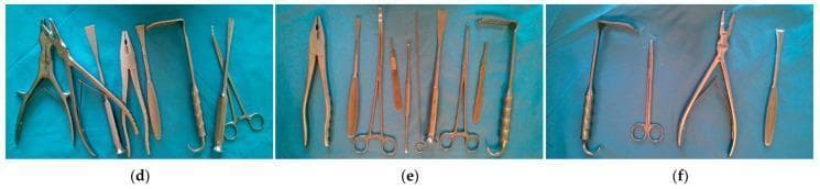 A series of three intraoperative clinical photographs (d, e, f) demonstrating various orthopedic surgical instruments arranged on a sterile blue drape to illustrate spatial configurations for medical object recognition systems. Image (d) displays a set of instruments, including bone forceps, tissue forceps, surgical clamps, and a periosteal elevator, arranged in a crossed and overlapping manner. Image (e) illustrates a densely packed but non-overlapping arrangement of tools such as multiple forceps types, surgical scissors, a thyroid retractor, and a scalpel handle. Image (f) shows a sparse, non-overlapping configuration featuring a thyroid retractor, surgical scissors, bone forceps, and a spreader. The collection highlights key morphological features of common surgical tools, emphasizing differences in head shapes, sizes (e.g., vascular forceps), and handle types used in basic orthopedic procedures. These images serve as educational examples for surgical tray organization and the development of automated instrument counting and identification algorithms in a clinical setting.