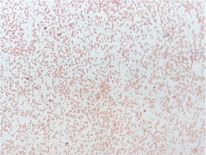 This diagnostic micrograph displays a Gram-stained smear of Pedobacter schmidteae strain EGT, a Gram-negative bacterium. The image shows a high density of pink/red stained bacterial cells, a color characteristic of Gram-negative organisms that do not retain crystal violet but take up the safranin counterstain. The morphology of the bacteria is consistently rod-shaped (bacilli). The cells are predominantly arranged individually or in loose, disorganized clusters, and are distributed across a relatively clear background with uniform staining intensity. This visual is representative of microbiology laboratory techniques used for the preliminary classification and morphological identification of bacterial isolates based on cell wall composition and shape.