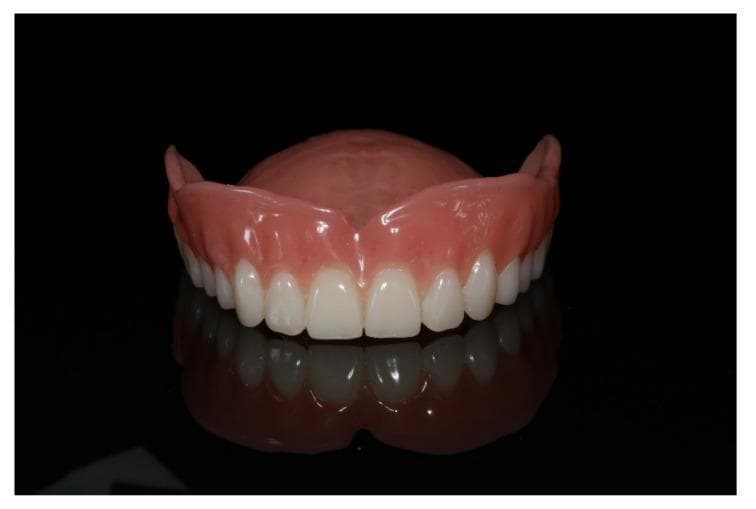 A clinical photograph of a final, polished maxillary (upper jaw) complete denture, shown against a dark, reflective background before insertion. The prosthesis features a pink, gingiva-colored base made of smooth, polished polymeric material (typically PMMA or milled CAD/CAM resin). The denture base includes a well-defined labial flange and a full palatal plate for suction-based retention. The artificial teeth are arranged in a symmetrical, curved dental arch, exhibiting a uniform bright white color and anatomical morphology consistent with natural dentition. The surface of both the base and teeth is highly reflective, indicating a high-quality finish aimed at reducing plaque accumulation and improving patient comfort. This image demonstrates the outcome of a prosthetic workflow, likely involving CAD/CAM fabrication for the restoration of an edentulous upper arch.