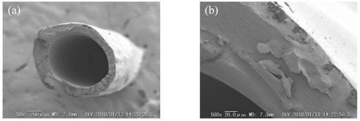 This figure presents Scanning Electron Microscopy (SEM) images detailing the morphology of a C-HF (cation-exchange hollow fiber) membrane, a key component used in medical and industrial separation processes like dialysis. Image (a) is a low-magnification (50x) cross-sectional view showing the global hollow fiber structure. It depicts a cylindrical tube with a central lumen, essential for facilitating fluid flow in diffusion dialysis or electrodialysis systems. The scale bar indicates a 200 µm dimension, illustrating the outer diameter and significant wall thickness of the fiber. Image (b) provides a high-magnification (500x) close-up of the cross-section with a 20.0 µm scale bar. This view reveals a non-porous, relatively dense matrix with irregular granular textures and surface irregularities. These features are indicative of the membrane's composite material properties resulting from the dehydration, coagulation, and chemical cross-linking processes (using glutaraldehyde) intended to optimize water content, mechanical strength, and ionic selectivity for selective ion transport.