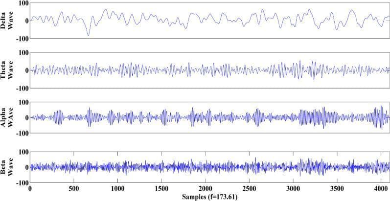 This Comparison Chart illustrates the four primary brain rhythm waveforms derived from human Electroencephalogram (EEG) data: Delta, Theta, Alpha, and Beta waves. The visualization displays each rhythm in a separate horizontal panel, plotted against a horizontal axis representing samples (0 to 4000) at a frequency of 173.61 Hz. The vertical axis for all panels indicates amplitude in microvolts (µV), ranging from -100 to 100. The Delta wave (0.5–4 Hz) shows the lowest frequency with broad, high-amplitude slow oscillations. The Theta wave (4–8 Hz) demonstrates increased frequency compared to Delta. The Alpha wave (8–14 Hz) exhibits a distinct intermediate frequency often characterized by synchronized bursts. The Beta wave (14–30 Hz) displays the highest frequency with rapid, dense oscillations and relatively lower amplitude. This educational diagram is used in neurology and clinical neurophysiology to teach the visual identification and frequency-amplitude relationships of different neurological states, such as wakefulness, relaxation, or sleep stages, based on EEG signal processing.