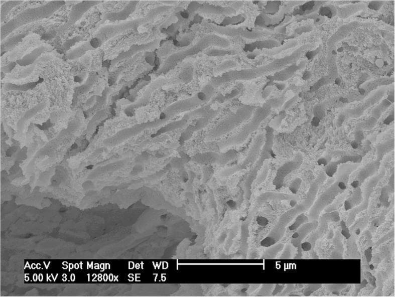 High-resolution Scanning Electron Microscopy (SEM) image of human compact bone at 12800x magnification. The visual shows the intricate micro-architecture of the inner bone lattice from an adult female humerus. The structure is characterized by well-preserved, interconnected trabecular-like patterns and uniform pore spaces, demonstrating a healthy or well-preserved solid bone matrix. The textured surface appears clean, with no visible soil contaminants, particulate matter, or cinnabar (mercury sulfide) inclusions despite high systemic mercury levels (137.41 μg/g). A 5 μm scale bar is provided for reference. This diagnostic imaging serves as a pathological and archaeological reference for assessing bone integrity and potential post-mortem environmental contamination versus ante-mortem metabolic accumulation of trace elements like mercury.