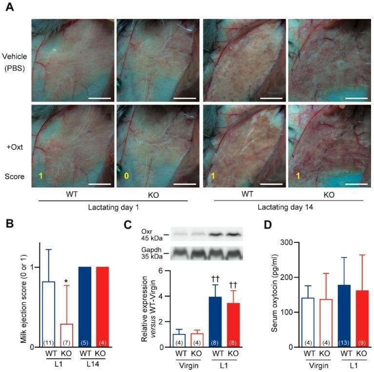 Multi-panel figure illustrating impaired milk ejection in cystathionine gamma-lyase deficient (Cth-/- or KO) mouse models. Panel A: Clinical photographs of surgically exposed abdominal mammary glands in wild-type (WT) and KO mice at lactating day 1 (L1) and day 14 (L14). Images compare milk ejection following vehicle (PBS) or oxytocin (+Oxt) application. In WT L1, oxytocin induces visible milk accumulation in larger ducts (Score 1), whereas KO L1 mice show a failure of milk ejection (Score 0). By L14, both genotypes exhibit Score 1. Panel B: Bar graph quantifying milk ejection scores (0 or 1), showing significant impairment specifically in L1 KO mice. Panel C: Western blot analysis of oxytocin receptor (Oxr) expression at 45 kDa, with Gapdh as a loading control at 35 kDa. The quantitative bar graph confirms significant upregulation of Oxr in both WT and KO mice during lactation compared to the virgin state. Panel D: Bar graph comparing serum oxytocin levels (pg/ml) between virgin and L1 stages, showing no significant difference between genotypes. This figure demonstrates that breastfeeding failure in Cth-/- models is due to peripheral oxytocin resistance rather than receptor deficiency or low circulating hormone levels.