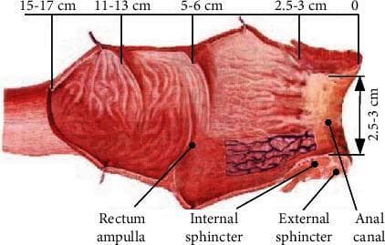 This anatomical diagram illustrates a longitudinal cross-section of the human rectum and anal canal, emphasizing spatial dimensions and clinical landmarks relevant for transrectal procedures. The illustration identifies the rectum ampulla as the proximal, dilated portion, transitioning distally toward the anal canal. Key muscular structures labeled include the internal sphincter and external sphincter. A horizontal scale at the top provides anatomical distance markers: 0 cm at the anal opening, 2.5-3 cm at the anal canal, 5-6 cm at the sphincter level, 11-13 cm at the mid-rectum, and 15-17 cm at the proximal rectal boundary. Vertical arrows also indicate the anal canal depth (2.5-3 cm). The diagram highlights the mucosal surface texture and the relative narrowness of the anal canal compared to the wider rectal ampulla, providing critical orientation for the insertion of diagnostic tools such as transrectal ultrasound (TRUS) probes used in prostate biopsies.