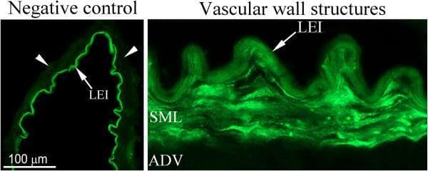 Diagnostic fluorescence microscopy images of human artery sections illustrating vascular wall histology and immunohistochemical controls. The image is divided into two panels. Left Panel (Negative Control): A cross-section of a cerebral artery where primary antibodies were omitted. It demonstrates prominent green auto-fluorescence of the lamina elastica interna (LEI), appearing as a bright, thin, undulating line. White arrowheads point to the smooth muscle cell layer (SML), which shows no specific immunoreactivity, serving as a baseline for experimental comparison. Right Panel (Vascular Wall Structures): An architectural overview of the arterial wall layers. Labeled structures include the outermost adventitial layer (ADV), the intermediate smooth muscle cell layer (SML), and the innermost lamina elastica interna (LEI). The LEI shows characteristic intense fluorescence and a folded morphology. The SML exhibits a more diffuse fluorescence pattern, representing specific staining or background across the tunica media. A 100 µm scale bar is provided for reference. This visual is intended for teaching vascular anatomy, immunohistochemical techniques, and the phenomenon of tissue auto-fluorescence.