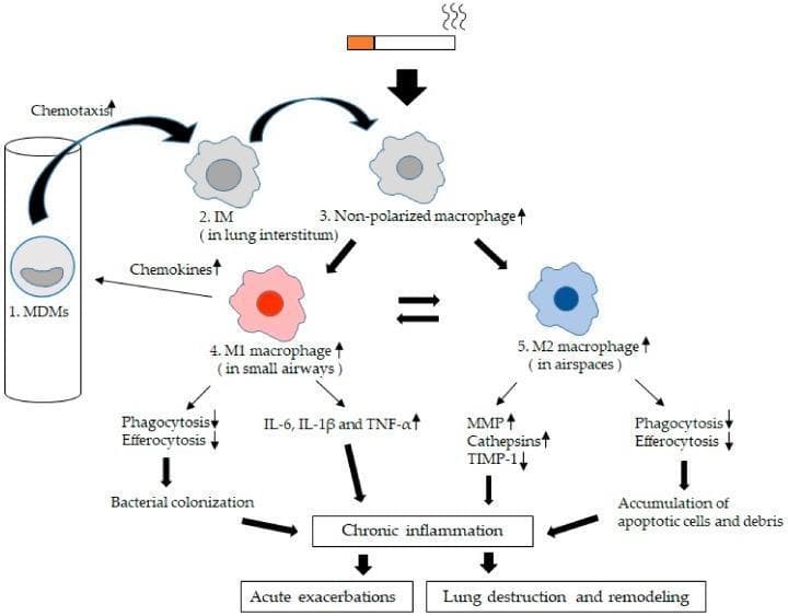 A pathophysiology diagram illustrating the kinetics and phenotypic polarization of lung macrophages (LMs) in Chronic Obstructive Pulmonary Disease (COPD). The diagram follows a progression starting from blood monocyte-derived macrophages (MDMs) that undergo chemotaxis into the lung interstitium to become Interstitial Macrophages (IMs). These transition into non-polarized macrophages within small airways and airspaces. Driven by the microenvironment—influenced by cigarette smoke—macrophages polarize into two main phenotypes: 1) M1 macrophages (classically activated), primarily in small airways, which show increased secretion of pro-inflammatory cytokines (IL-6, IL-1̢̣, TNF-̢̣) and impaired phagocytosis/efferocytosis, leading to bacterial colonization. 2) M2 macrophages (alternatively activated), primarily in airspaces, characterized by increased MMPs and cathepsins with decreased TIMP-1, contributing to the accumulation of apoptotic cells and debris. Both pathways converge on chronic inflammation, which subsequently drives acute exacerbations and structural lung destruction/remodeling. This educational infographic visualizes the immune mechanisms underlying COPD progression and the functional impairment of cellular defense in the lung.
