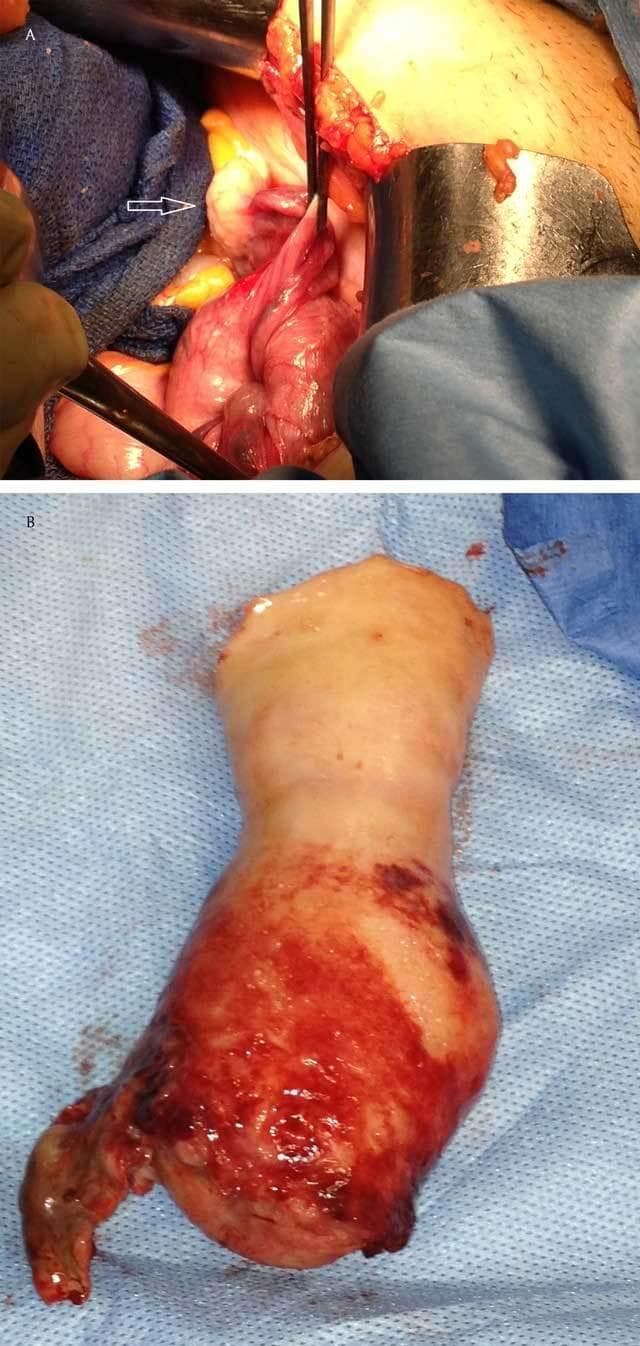 Hugging Face pmc clinical VQA raw